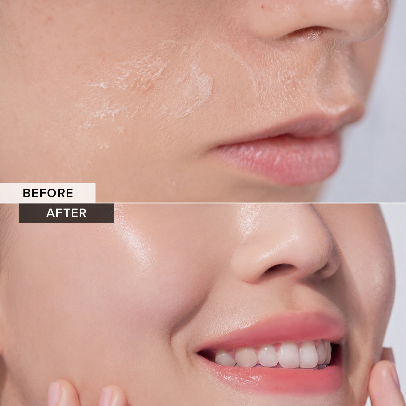 Oil Control - Gentle Foam Cleanser