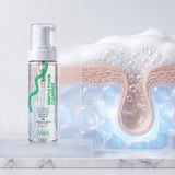 Oil Control - Gentle Foam Cleanser