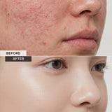 Barrier Reset Micellar Water